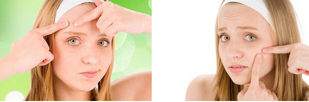 深圳膚康治療青春痘醫院