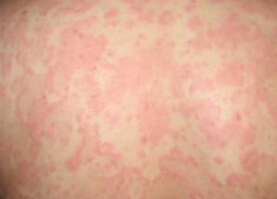 �����ί��n����õ��tԺ