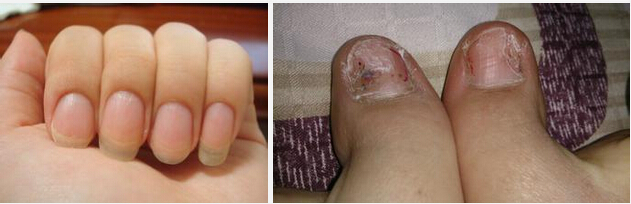 �����ί���ָ�׌����tԺ