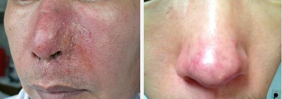 �����ί�����ǰY��DƬ