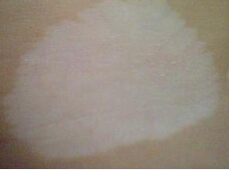 ����L�����tԺ