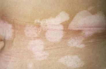 ���ڰ���L�ί��tԺ