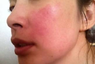 深圳膚康皮膚病專科