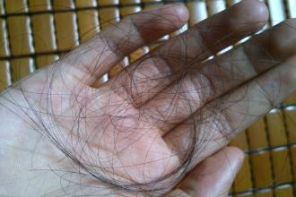 頭發(fā)掉的厲害什么原因